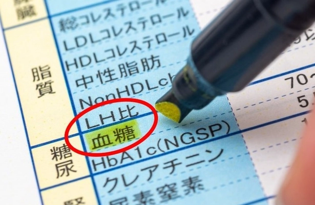 コレステロール管理の指標「LH比」の重要性について 特集した記事を健康情報サイト「RAYDEL」にて公開