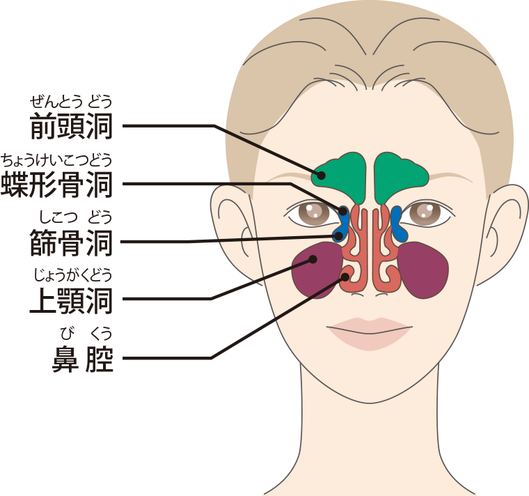 副 鼻 鼻腔 炎 うがい 副鼻腔炎の手術から1週間、鼻うがいの日々と一時的に味覚と嗅覚の機能がなくなる！