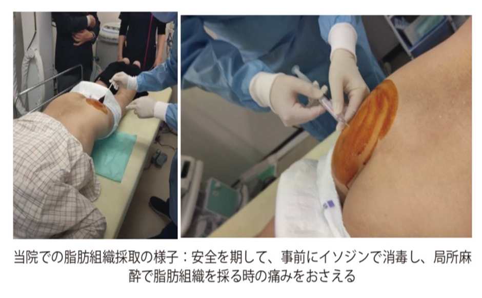 治療現場の様子