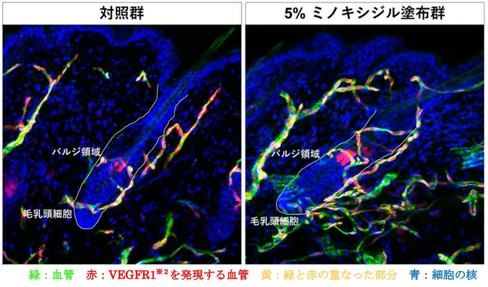 図１　ミノキシジル塗布による毛包周囲の血管の増加