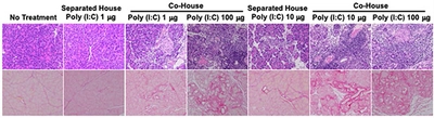 腸内フローラの変化による自己免疫性膵炎の発症メカニズムを解明　新たな治療法の開発へ期待