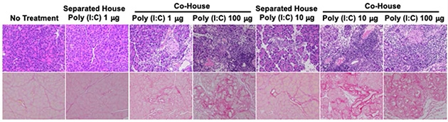 腸内細菌の移行による自己免疫性膵炎の発症促進作用（上段；膵臓の炎症をHematoxylin ＆ Eosin染色で観察したもの、下段；膵臓の線維化をSirius Red染色で観察したもの）