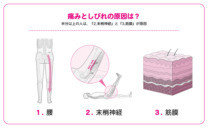 半分以上の人は、『2.末梢神経』と『3.筋膜』が原因