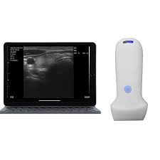 眼科用チャートプロジェクタ市場、2032年に818百万米ドルへ CAGR7.4%で成長予測