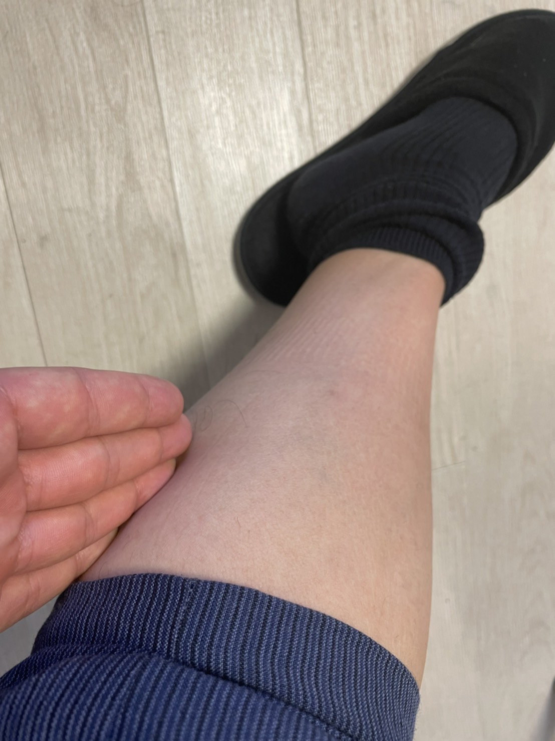 メンズ脱毛=女性ウケ抜群!学生でも出来る夏の無駄毛処理!