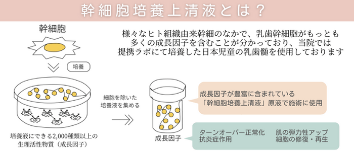 ヒト乳歯幹細胞培養上清液とは