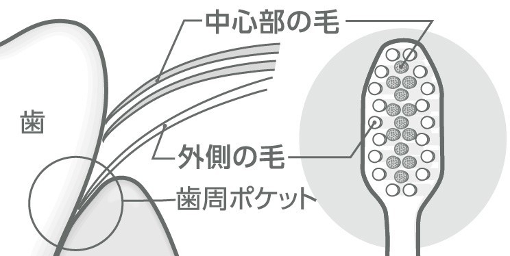 図1：付替システマ