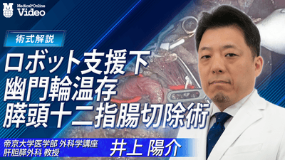 ロボット支援下 幽門輪温存膵頭十二指腸切除術