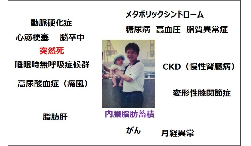 様々な病気につながる内臓脂肪蓄積