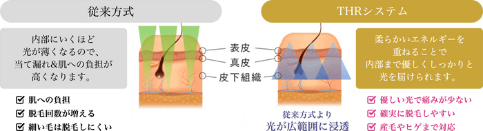 2．業務用脱毛機に導入しているTHRシステム