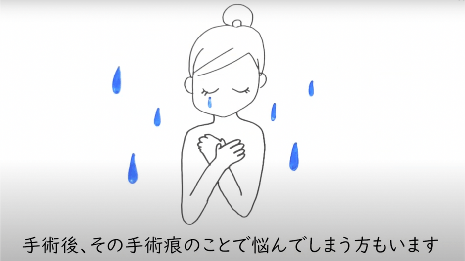 手術痕で悩む人も