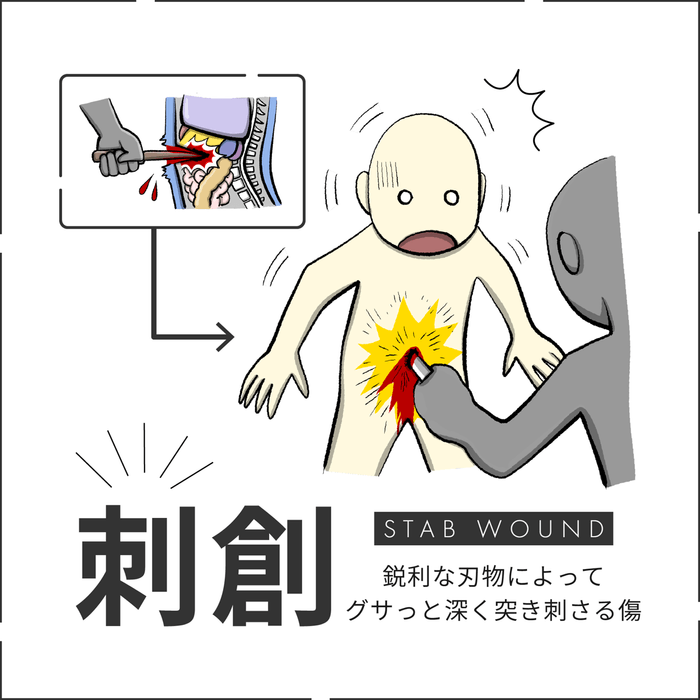 刺創
