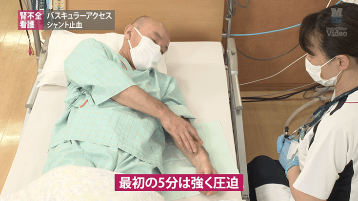 バスキュラーアクセス シャント止血