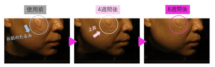 図6　F-ray解析によるたるみの変化の様子