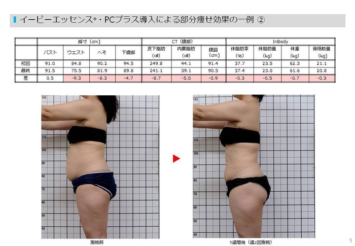 イーピーエッセンス・PCプラスの有用性試験結果(痩身)2