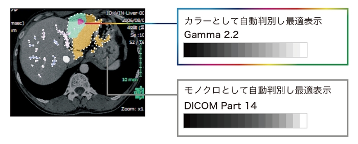 Hybrid Gamma PXL機能