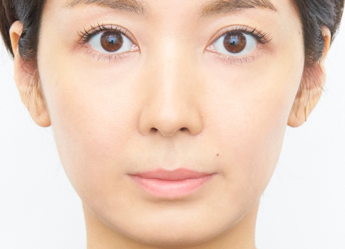 A:唇が荒れていない女性