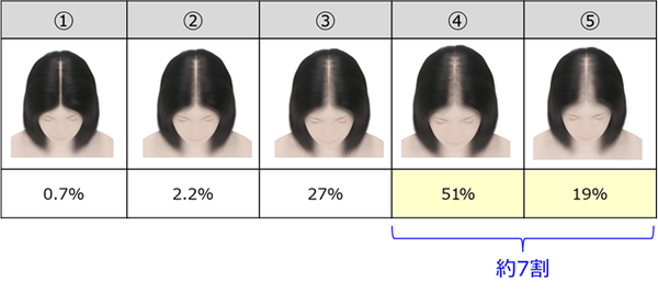 Q2. あなたは、次の頭髪状態のうち、どこからが「壮年性脱毛症」だと思いますか。あてはまるものをひとつお知らせください。