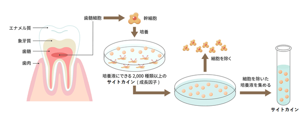 「ヒト乳歯由来幹細胞培養上清液」とは