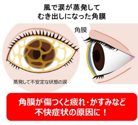【実験】夏は「角膜の傷リスク」の高いシーンが多い！？ ハンディ扇風機で短時間でも涙が蒸発、 「角膜の傷リスク」が高まっていることが明らかに　 夏のアイケアを眼科医有田 玲子先生がご紹介