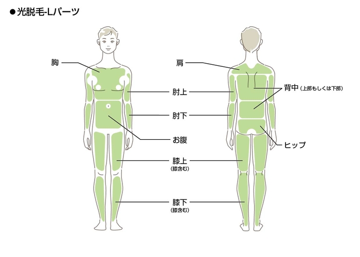 光脱毛Lパーツ