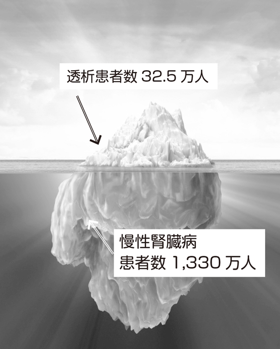 慢性の腎臓病患者さんは推定1,330万人、日本人の1割以上を占めている