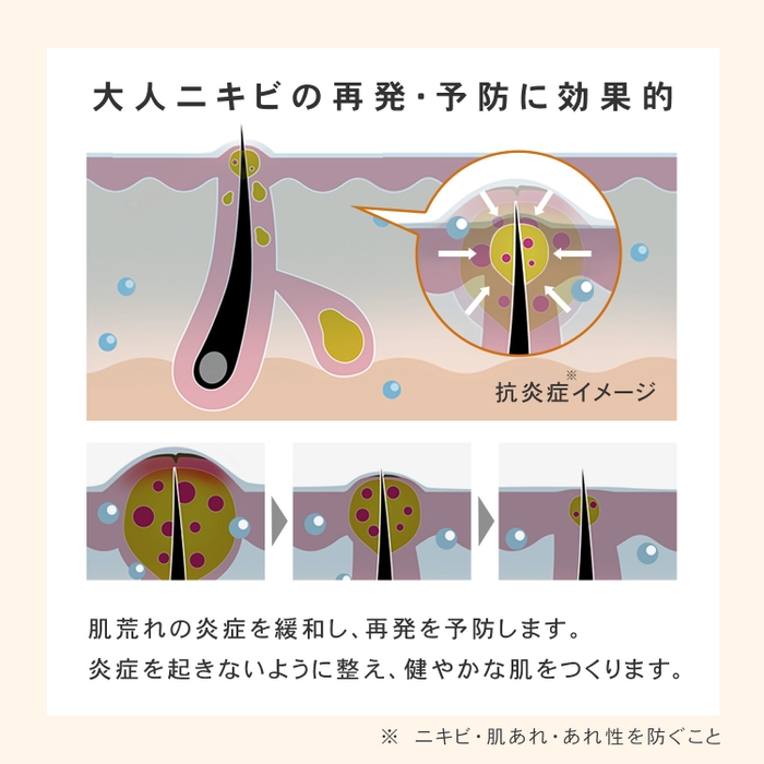 低刺激で負担の少ない、抗炎症*2作用のある有効成分