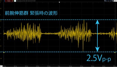 MyoScan計測データ