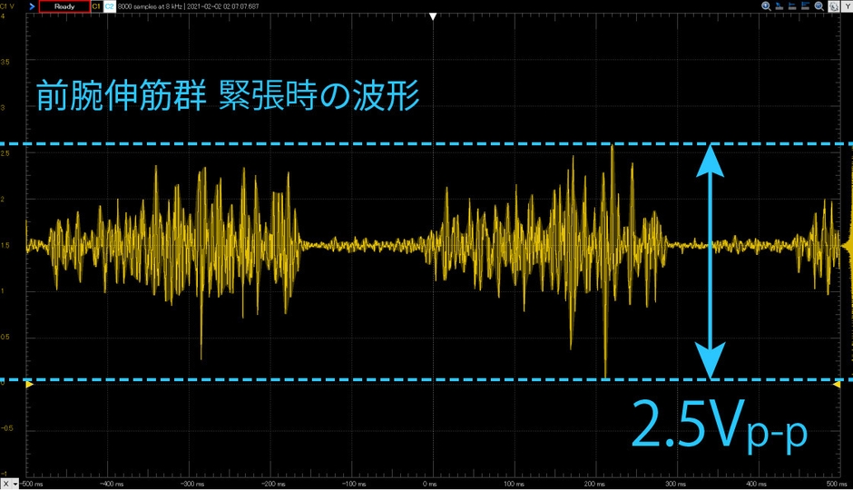 MyoScan計測データ