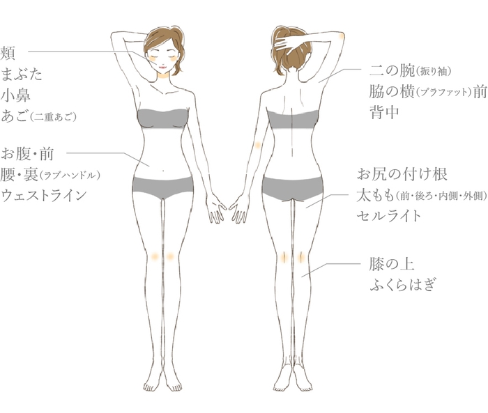 脂肪溶解注射「Key X Liner Mesotherapy　キーライナー」は、 頬、あごといった顔のパーツはもちろん、二の腕、お腹、お尻、太ももなど様々な部位の部分痩せに適しています。