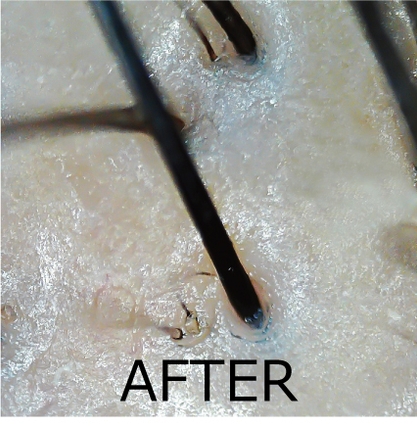 毛穴シャンプー使用後