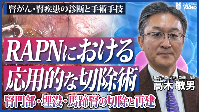 腎がん RAPNにおける応用的な切除術