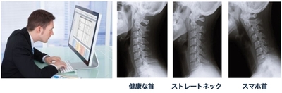 首を酷使して不調気味の現代人