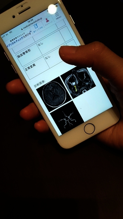 検診結果はスマホで確認