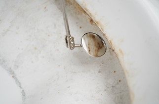 便器のフチ裏:尿石・黄ばみ