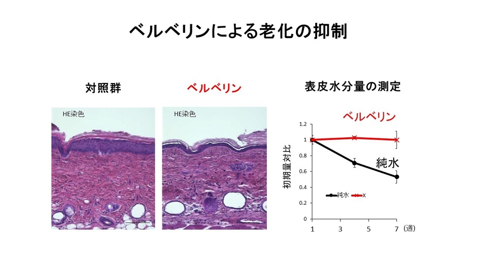 ミトコンドリア機能異常と老化疾患　講演スライド2