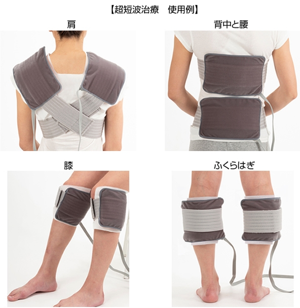 超短波治療 使用例