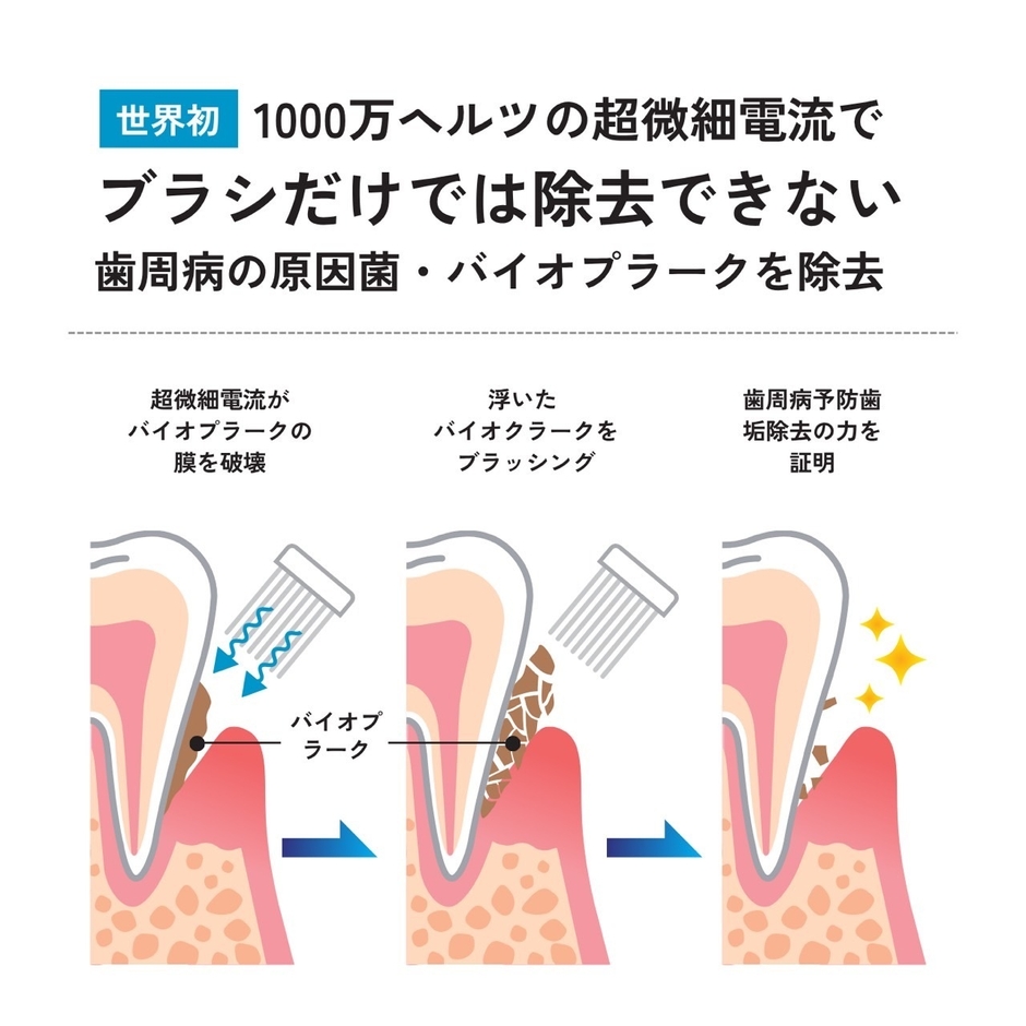 歯周病の原因菌・バイオプラークを除去