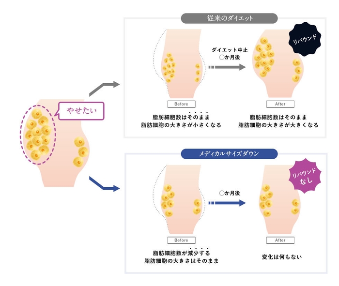 リバウンドの仕組み