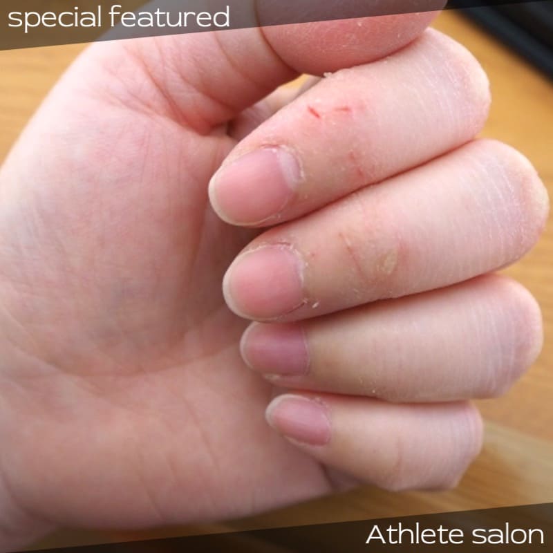 コロナ禍の冬に知っておくべき指先の３大乾燥対策 手荒れ ひび あかぎれに Newscast