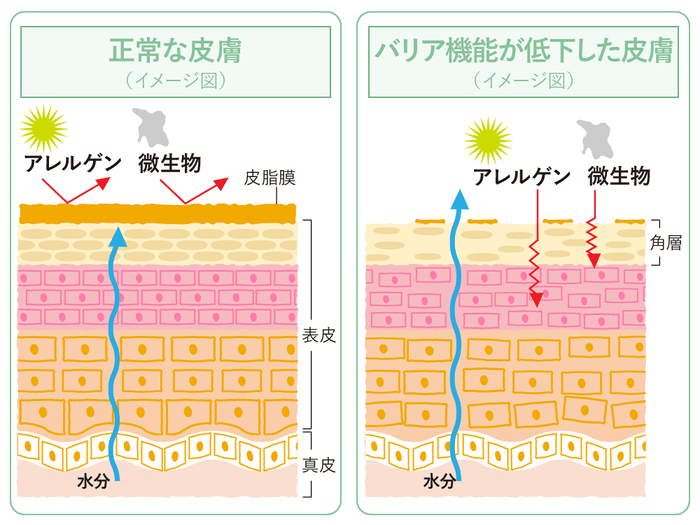 バリア機能の低下がマスク肌荒れを招く