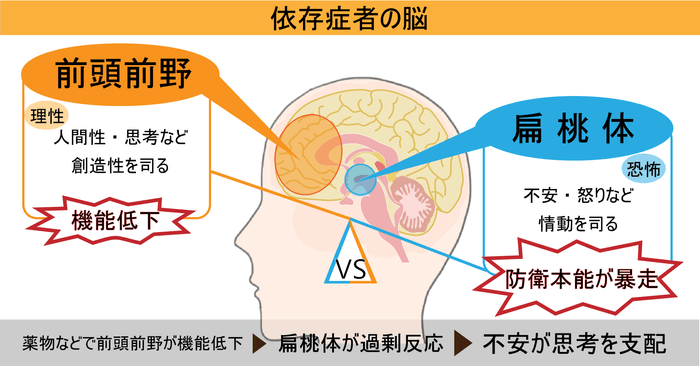 09_依存症者の脳(図解)