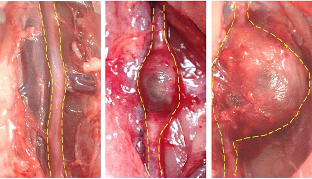 正常な血管(左)、通常のメスに形成される腹部大動脈瘤(中央)、卵巣摘出したメスに形成される腹部大動脈瘤(右)