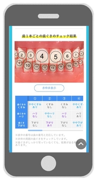 歯1本ごとのぐきのチェック結果