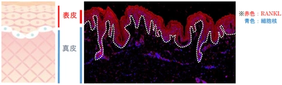 免疫と骨の健康に関わるタンパク質「RANKL」が 皮膚のバリア機能及び保湿機能を強化することを発見　 第6回日本骨免疫学会にて発表