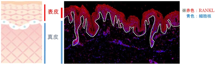 表皮に多く発現する「RANKL」