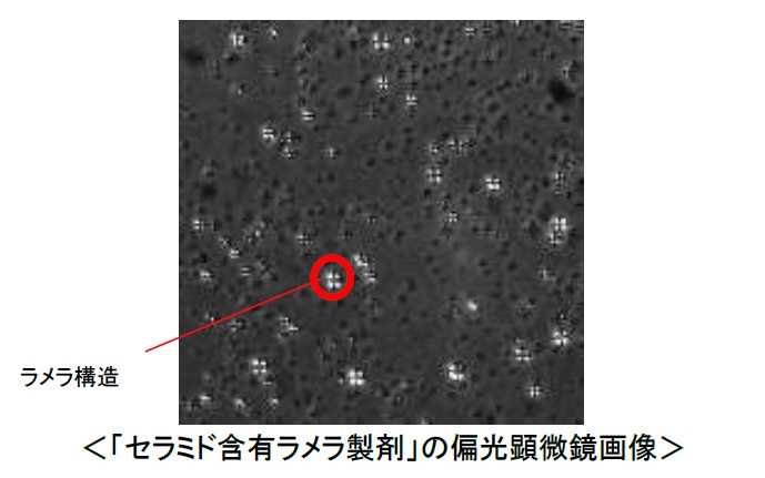 「セラミド含有ラメラ製剤」の偏光顕微鏡画像