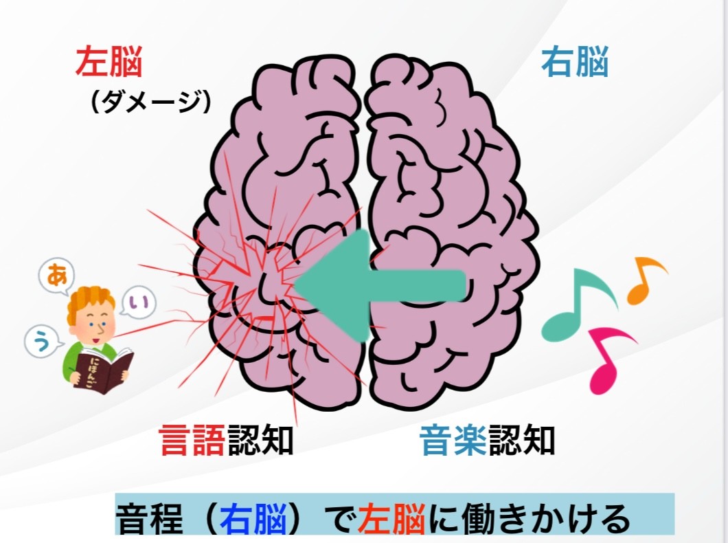 メロディックイントネーションセラピーの仕組み