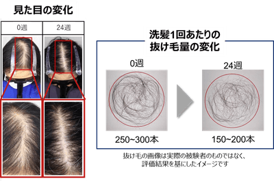 図4　著効例