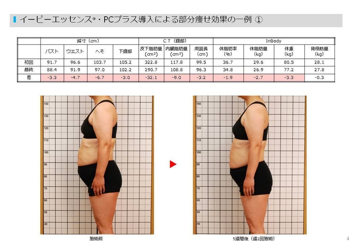 イーピーエッセンス・PCプラスの有用性試験結果(痩身)1